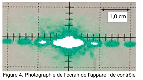 Figure 4 : photographie de l'écran de l'appareil de contrôle. Sur un fond clair quadrillé de pointillés, une rangée horizontale de taches vertes s'étend de part et d'autre du centre ; la tache centrale, blanche, est nettement plus large que les autres. Une double flèche placée en haut à droite, accompagnée de la mention « 1,0 cm », donne l'échelle de la photographie.