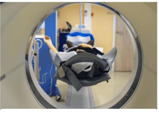 Photographie prise à travers l'anneau d'un appareil d'imagerie médicale : un patient allongé sur la table d'examen, la tête maintenue par un dispositif, et un soignant à l'arrière-plan.