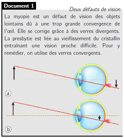 Schémas (a) et (b) montrant la position de l'image par rapport à la rétine